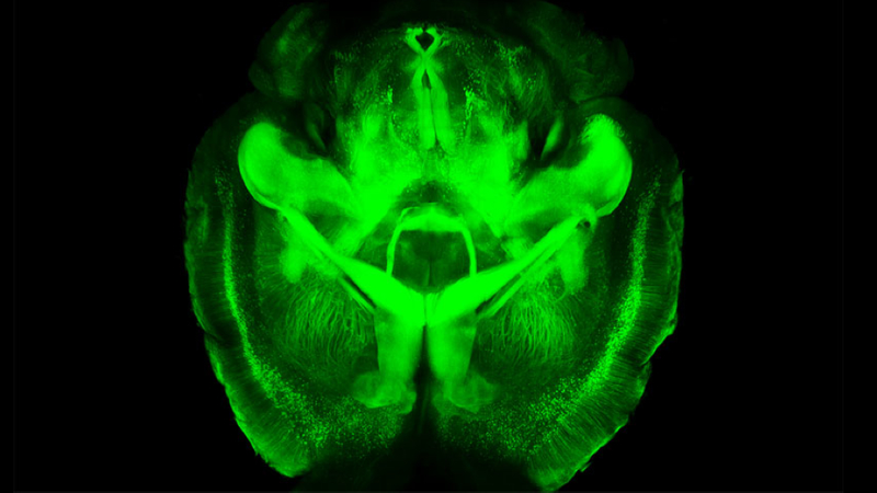 Illustration for article titled Scientists can now turn brains invisible